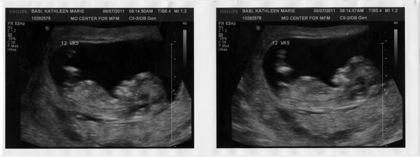 12-week ultrasound June 7 2011