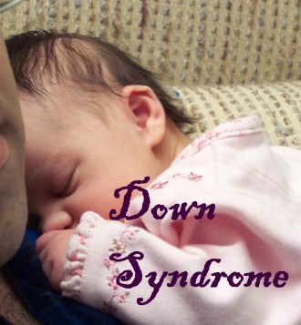 Blog Down Syndrome